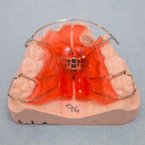 Aparato-ortodoncia